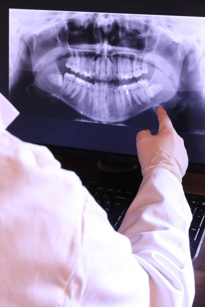 Best Chipped Tooth Repair Near Me  in Goshen, KY